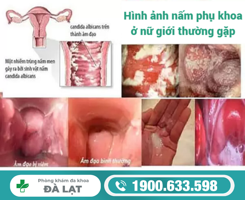 Hình ảnh minh họa